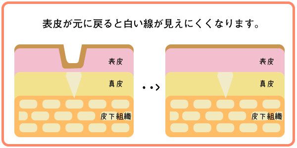 肉割れを消す解説
